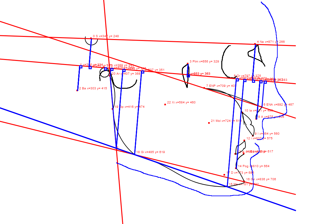 cephalometrics